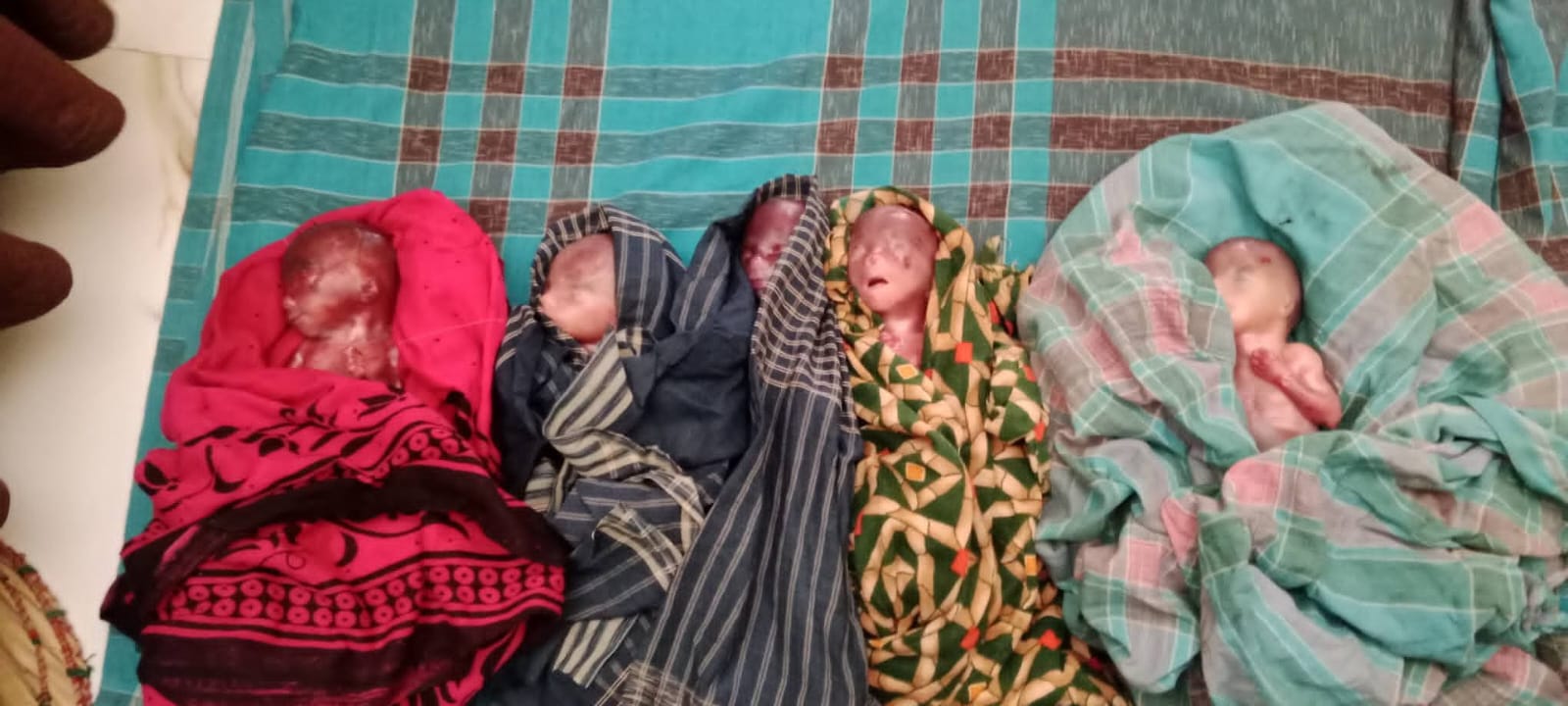শার্শায় একসঙ্গে ৫ সন্তানের জন্ম দিলেন গৃহবধূ, জন্মের পরপরই সবার মৃত্যু