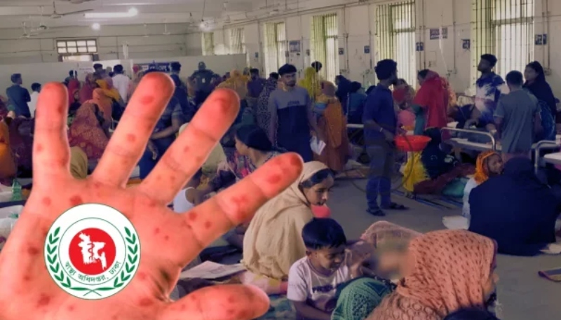 দেশে হাম ও উপসর্গ নিয়ে আরো ৭ জনের মৃত্যু