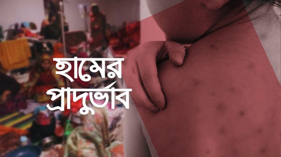 হাম ও উপসর্গ নিয়ে আরও ১০ জনের মৃত্যু