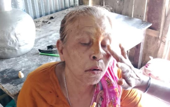 শ্যামনগরে লাথি দিয়ে মা’য়ের দাঁত ভাঙলো গুনধর ছেলে