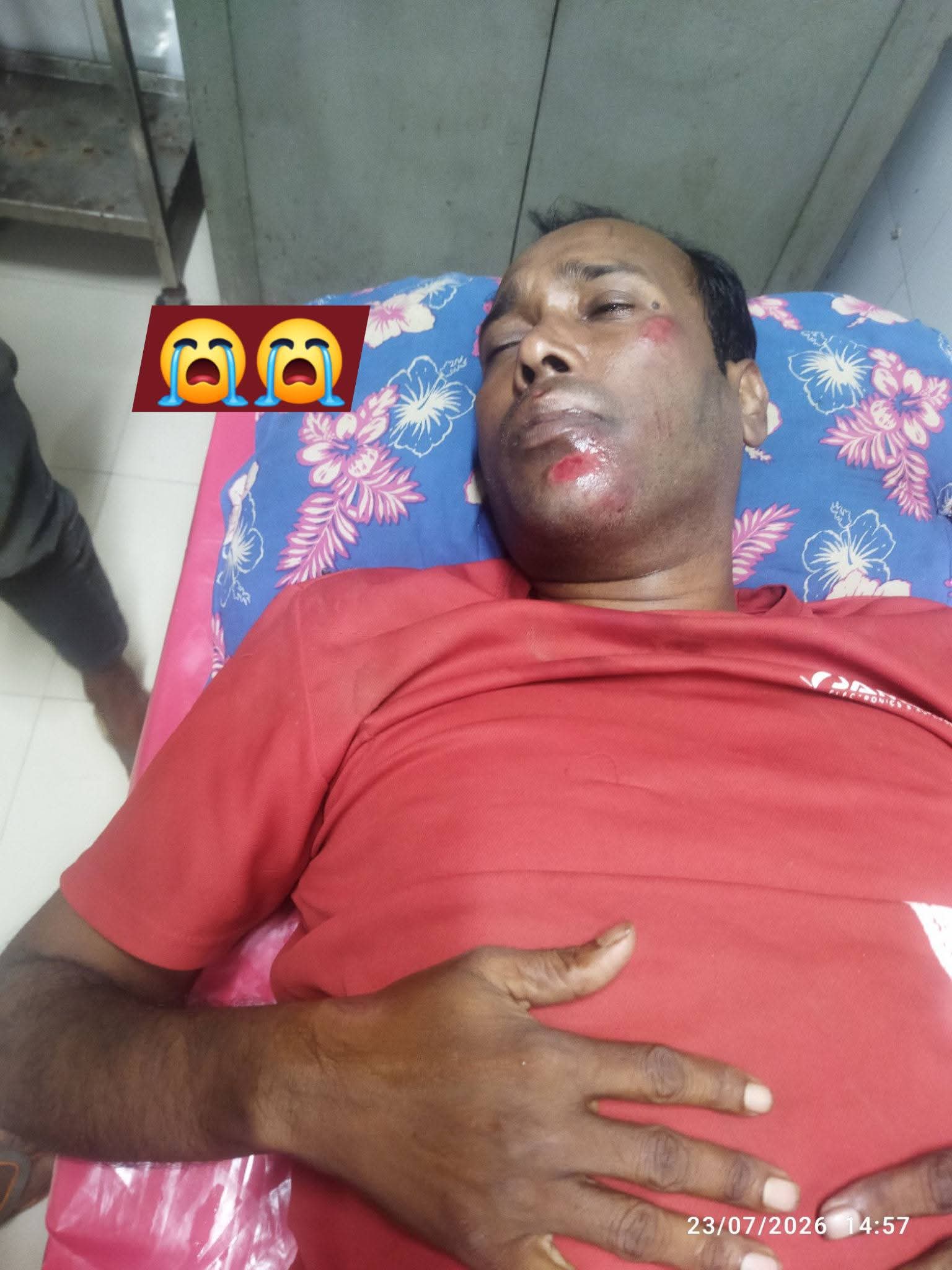 পাটকেলঘাটায় সড়ক দুর্ঘটনায় সাংবাদিক গুরুতর আহত