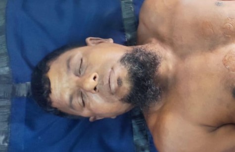 নুরনগরে অপারেশনে রোগীর মৃত্যু, ভুল চিকিৎসার অভিযোগ, ঘটনাস্থলে পুলিশ