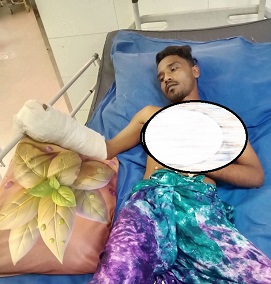 বিচালি কাটা মেশিনে কেটে গেল কলেজছাত্রের হাতের ৫টি আঙুল