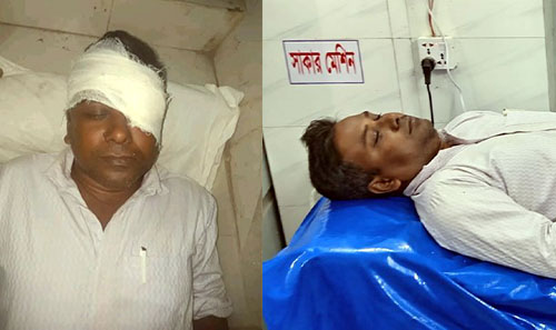 বিদ্যালয়ের পানির ড্রাম চুরির প্রতিবাদ করায় দুই শিক্ষককে পিটিয়ে জখম