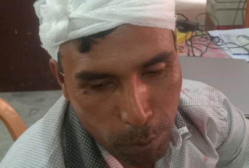 পাইকগাছায় নেশার টাকা না পেয়ে ইটের আঘাতে পিতার মাথা ফাঁটালো ছেলে