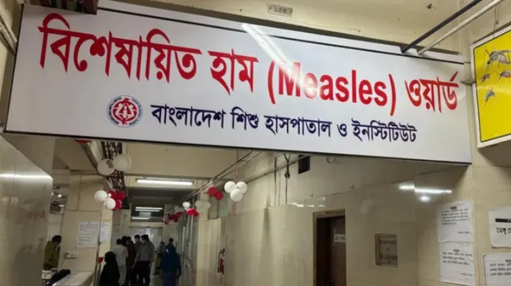 একদিনে হাম উপসর্গে ৭ জনের মৃত্যু