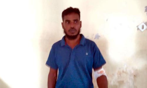 আশাশুনিতে জমি নিয়ে বিরোধ, শাবলের আঘাতে আহত ২